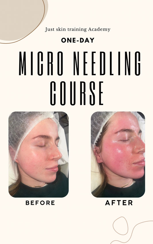 Microneedling One-Day Course
