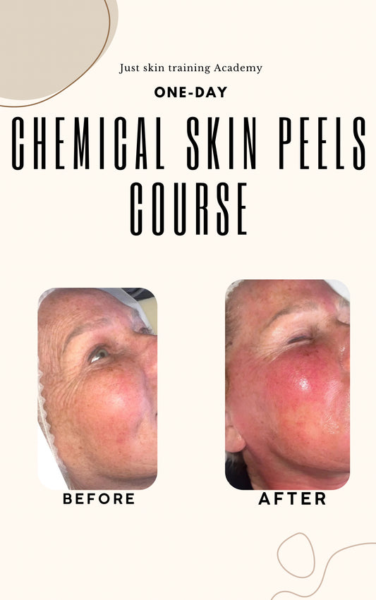 Chemical skin Peels course ￼