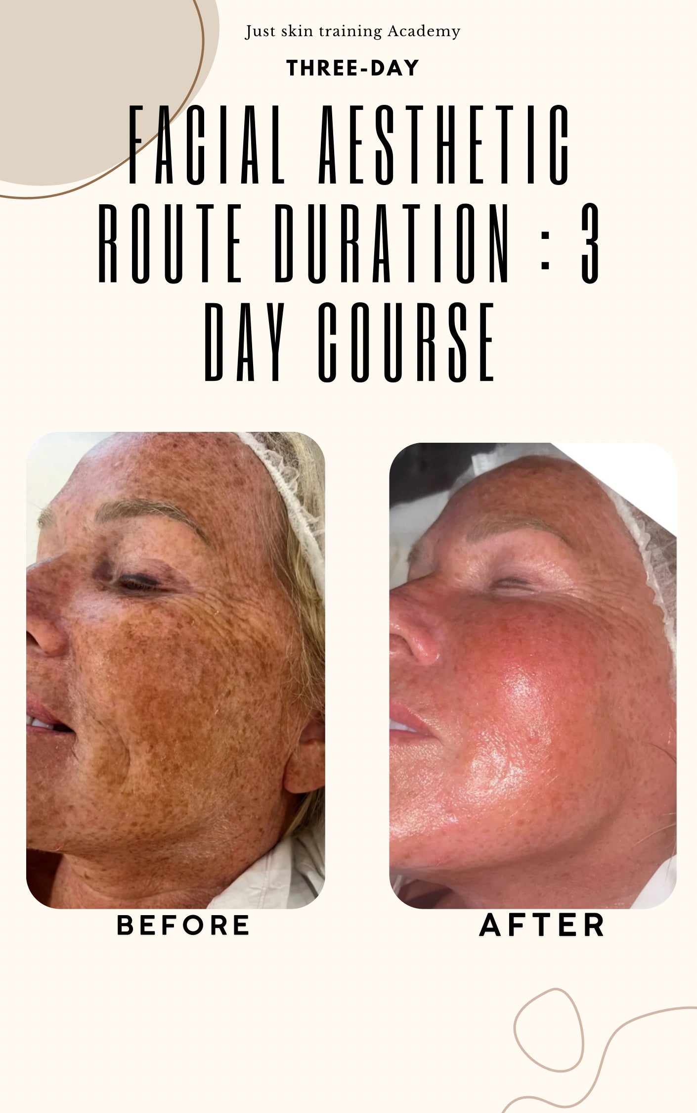Facial aesthetic route
Duration : 3 Day course